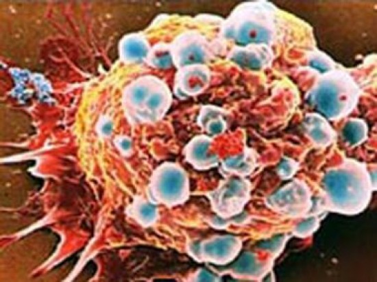 A rákterápiák veszélyes rákőssejteket kialakulását támogathatják