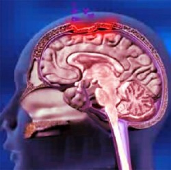 Fertőző agyhártyagyulladás - nem számítanak újabb megbetegedésekre a szakemberek