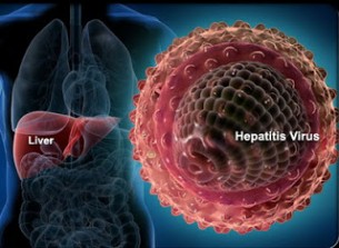  100 000 beteg tünet nélkül - a hepatitis Magyarországon