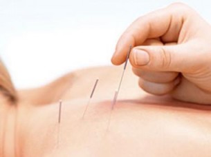 Az akupunktúra, mint hagyományos kínai orvoslás