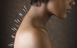 Az akupunktúra új ága: a kozmetikai akupunktúra