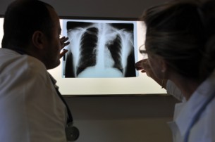 Diagnózis: Tüdőrák - Milyenek az esélyek?