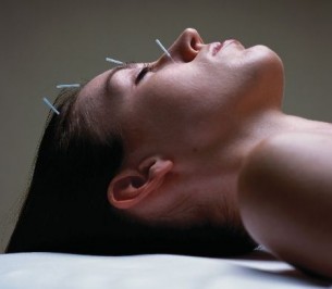 Egy páciens tapasztalata a kozmetikai akupunktúráról
